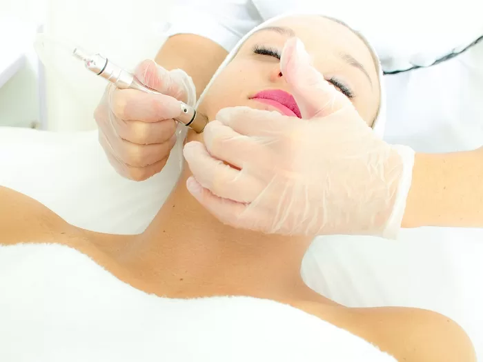 interior-microdermabraziune3.jpg