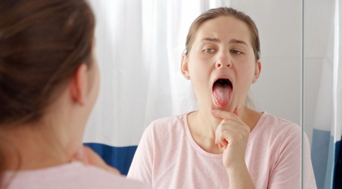 Semne de avertizare ale cancerului oral