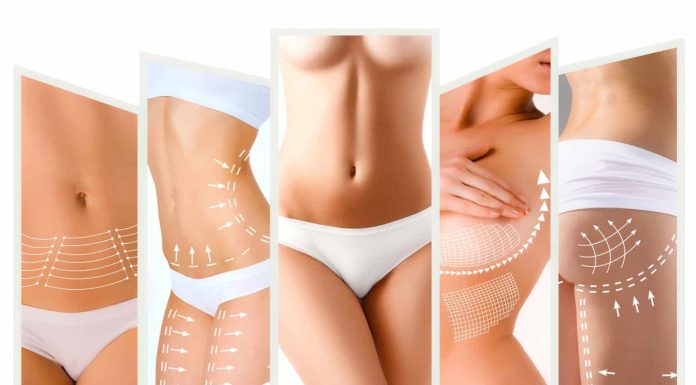 Cum să scapi de celulită în mod francez